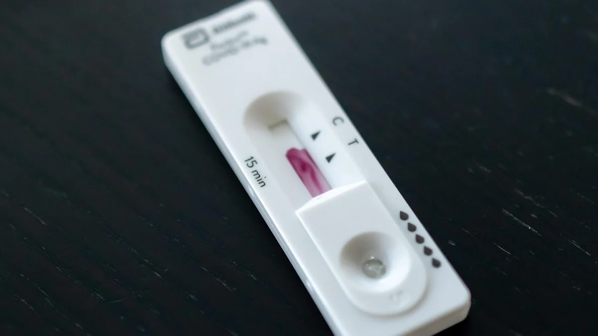 간 기능 검사 항목별 수치 의미와 이상 시 신체 변화 해석