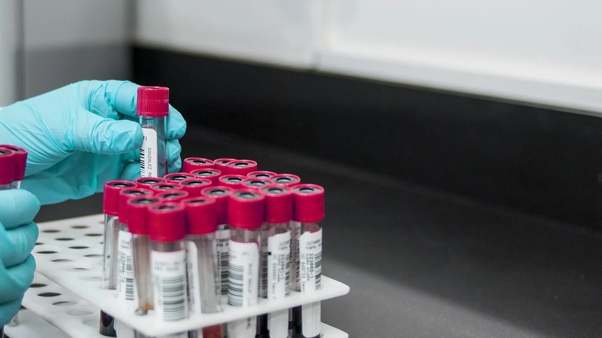 간 기능 수치별 이상 신호와 신체 구조 변화 이해하기