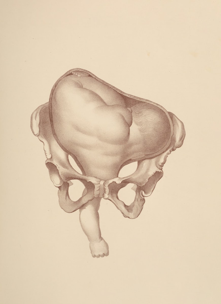 Artificial LaborPresentations of the Shoulders and Arms 1885