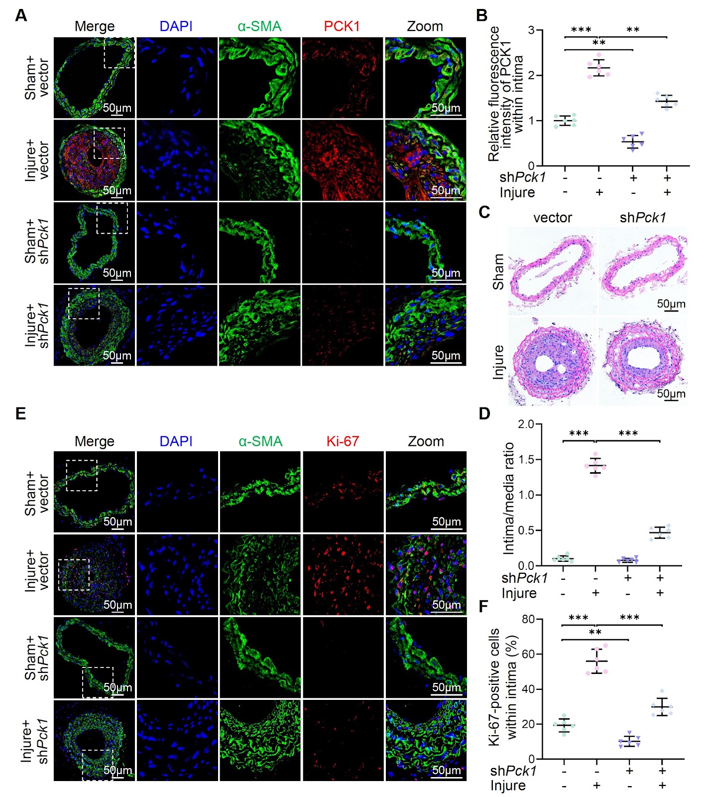 Silencing of PCK1 mitigates the proliferation and migration of vascular smooth muscle cells and vascular intimal hyperplasia by suppressing STAT3/DRP1-mediated mitochondrial fission