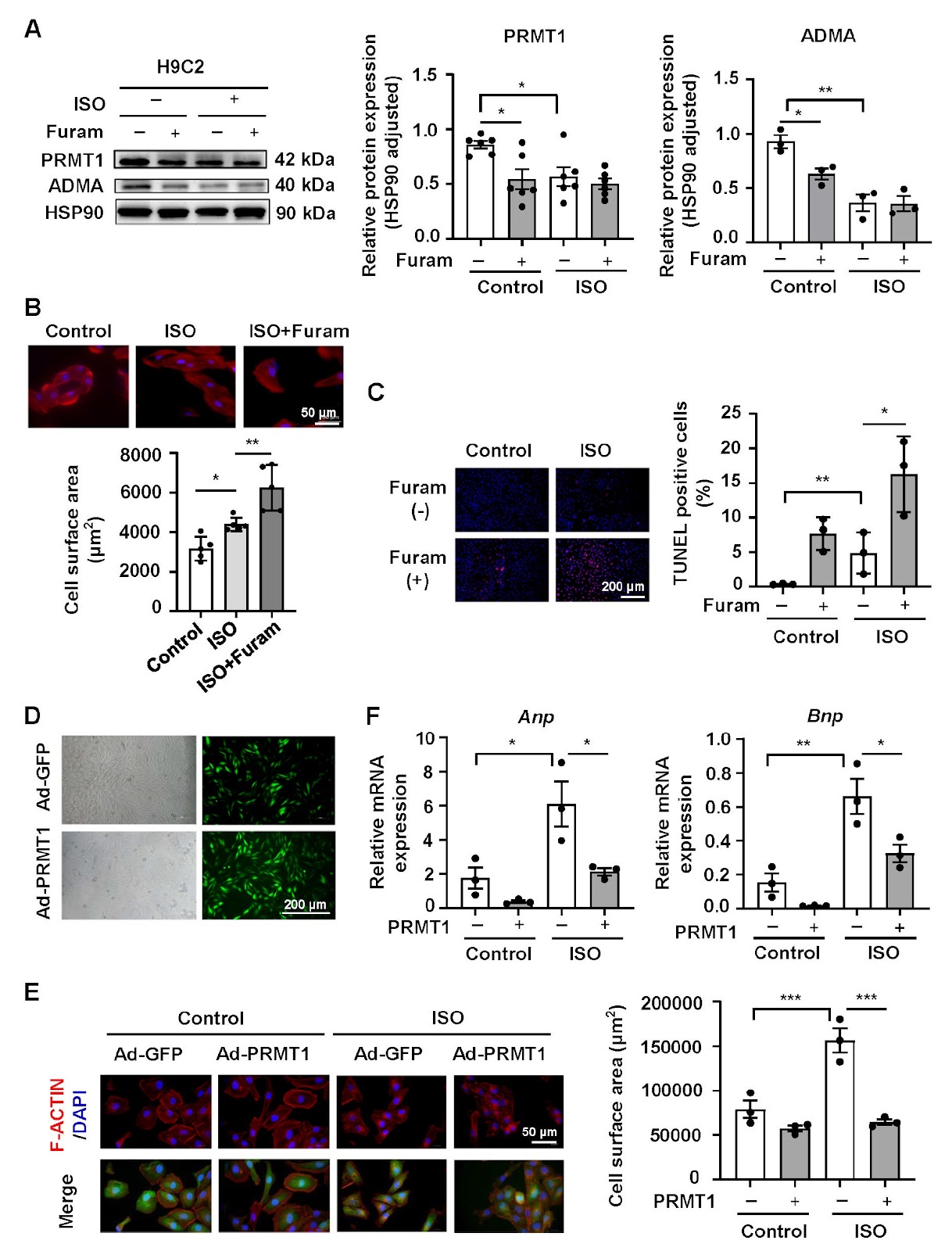 PRMT1 alleviates isoprenaline-induced myocardial hypertrophy by methylating SRSF1