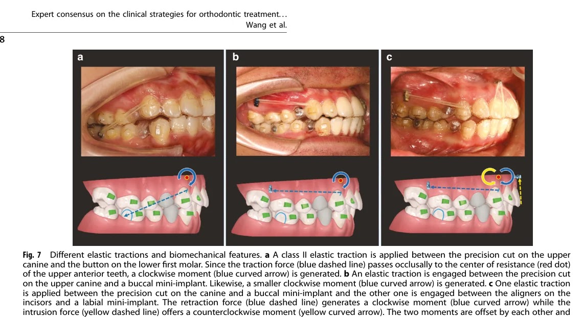 탄성 견인과 생역학