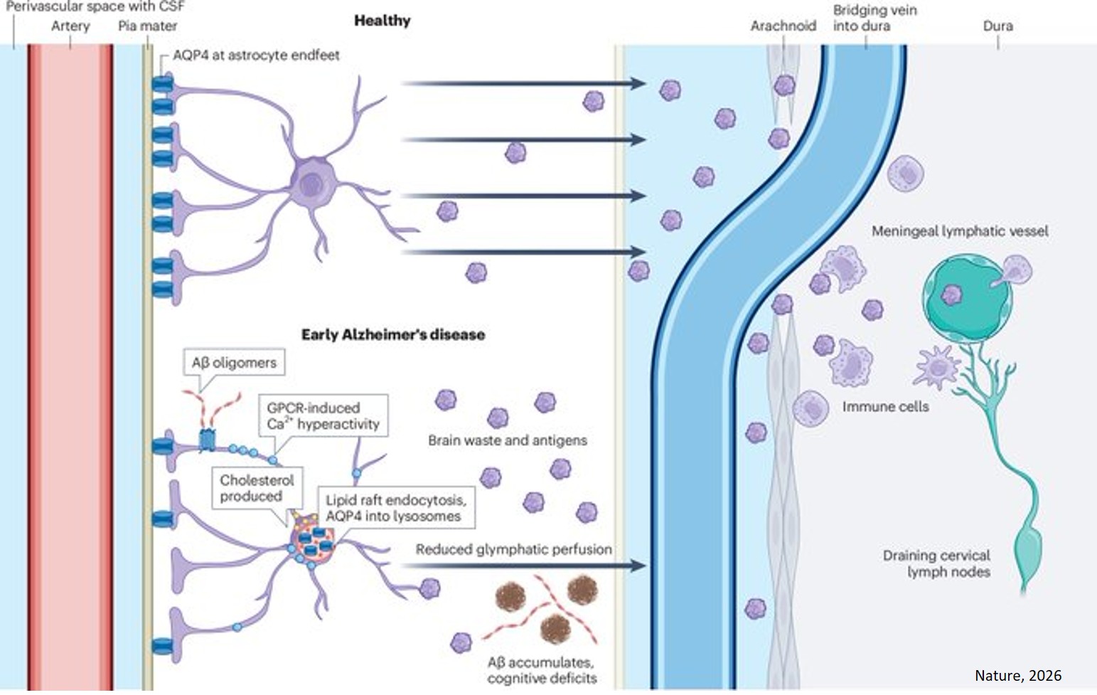    Increased astrocyte cholesterol is linked to amyloid-β-driven glymphatic dysfunction in Alzheimer’s disease