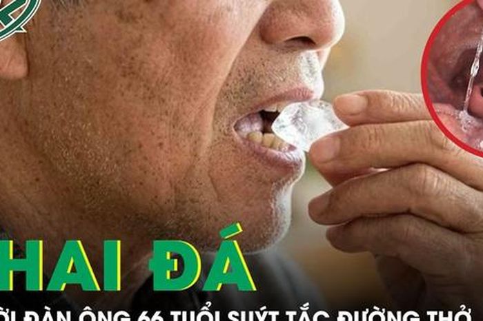 Nhai đá giải nhiệt, người đàn ông 66 tuổi suýt tắc đường thở - Báo Sức Khỏe &amp; Đời Sống