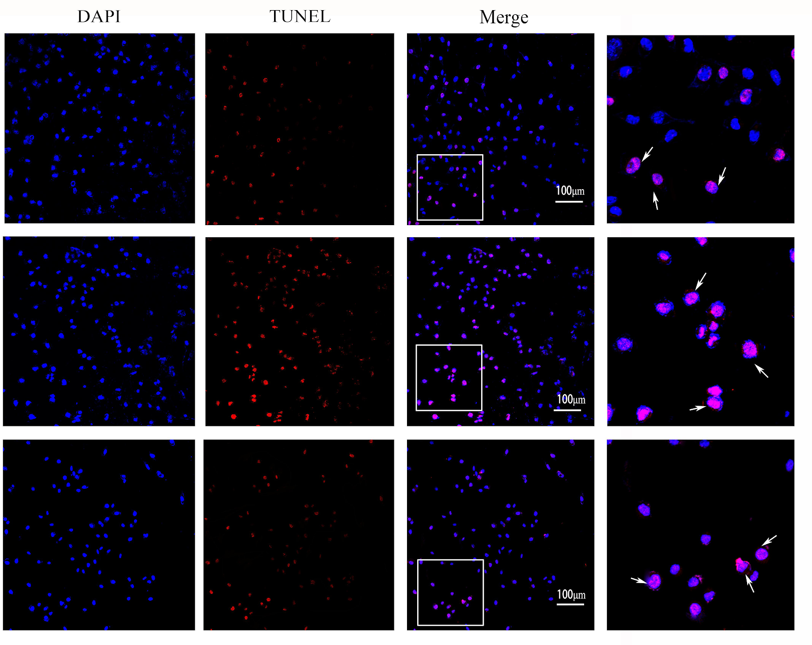 Mitochondrial kinetic mechanism by which triptolide alleviates hydrogen peroxide-induced apoptosis in SH-SY5Y cells