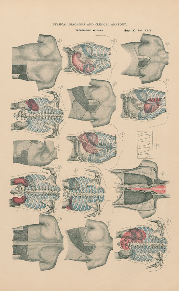 Boundaries Of Sound In Percussion And Auscultation 1888