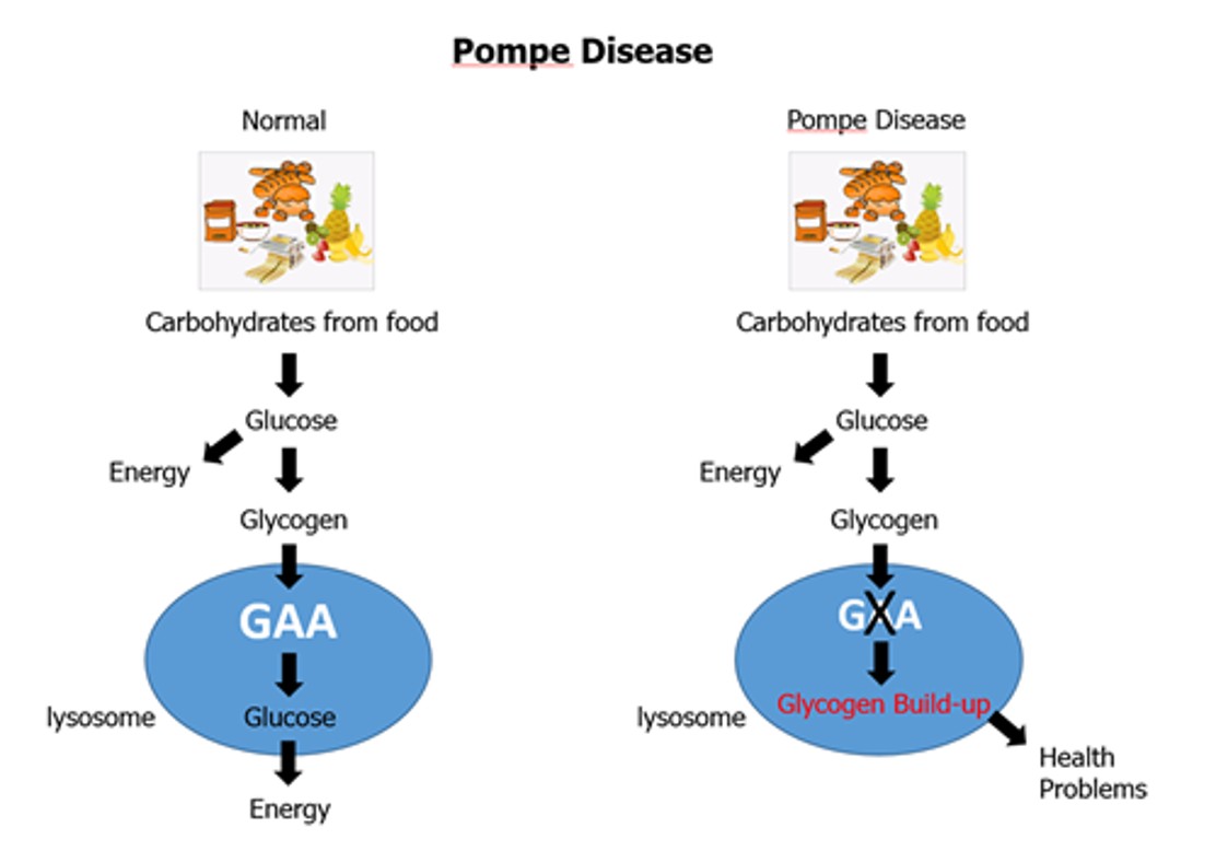 Defining the Genotype-CRIM Status Relationship in a Large Cohort of 215 Patients with Infantile-onset Pompe Disease