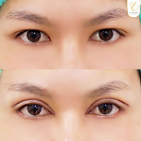 ตา 2 ชั้น