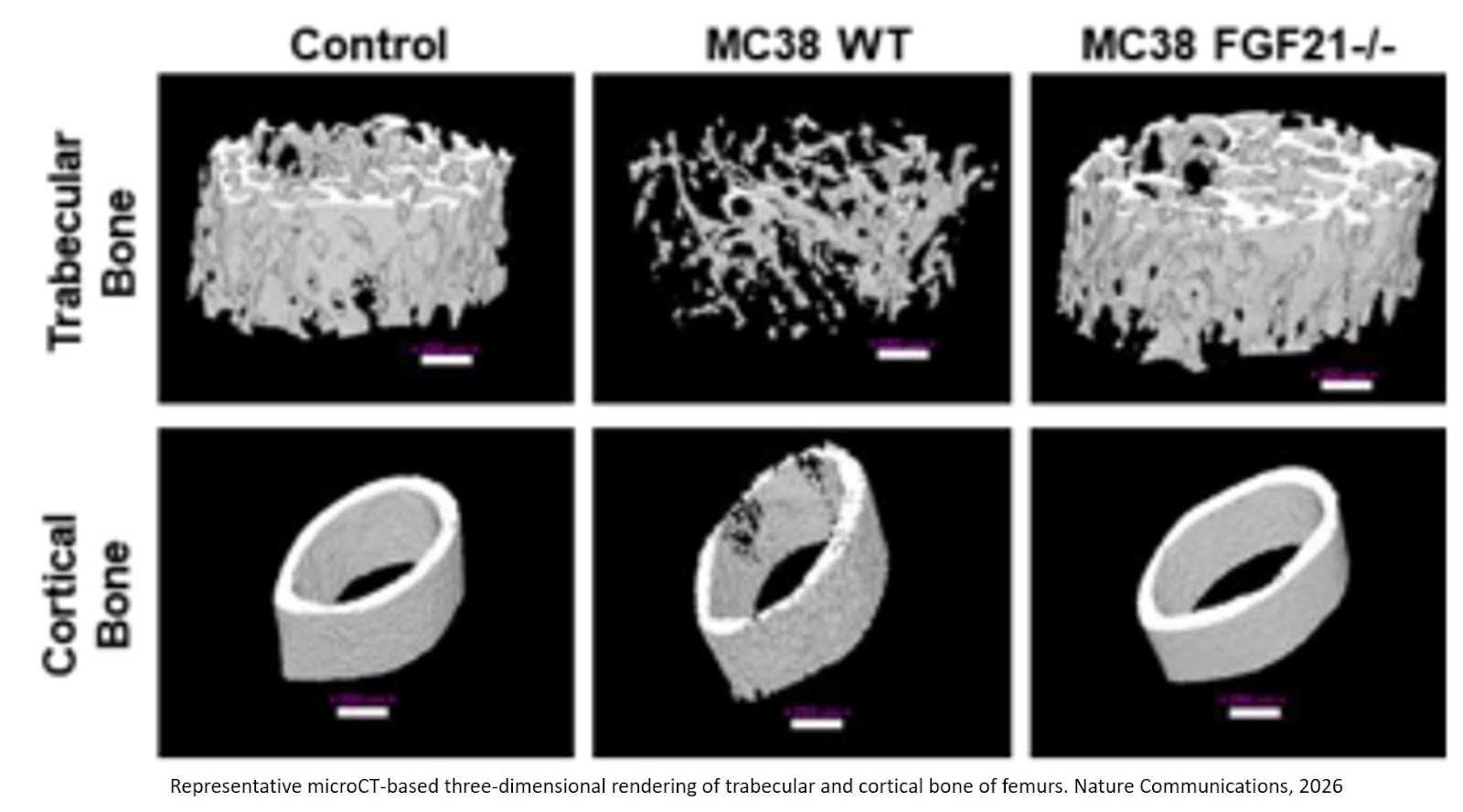 An FGF21-IGFBP1 tumor-liver relay drives musculoskeletal defects in colorectal cancer cachexia