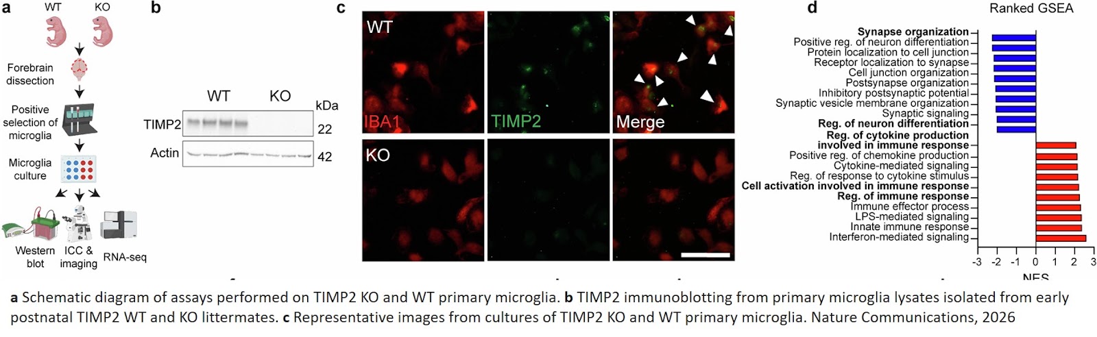 Youth-associated protein helps restore healthy function in immune cells in the aging brain