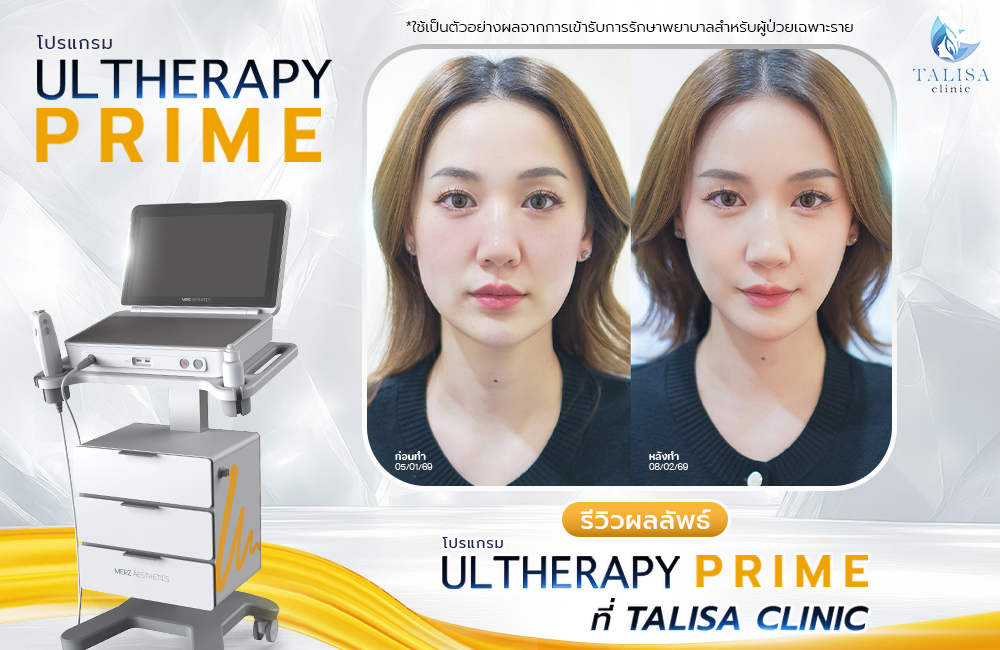 ผลลัพธ์ยกกระชับผิว Ulthera Prime Max ที่ TALISA Clinic
