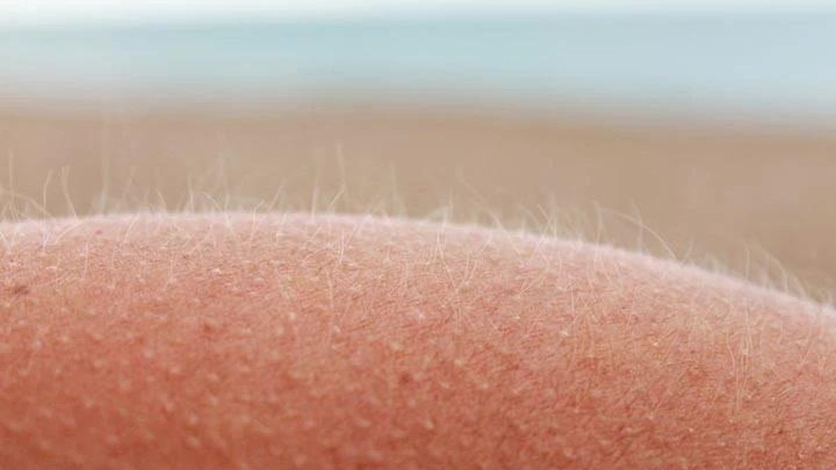 Giải mã bí ẩn trăm năm về lông tơ giúp trị chứng ngứa - Báo Tri thức &amp; Cuộc sống