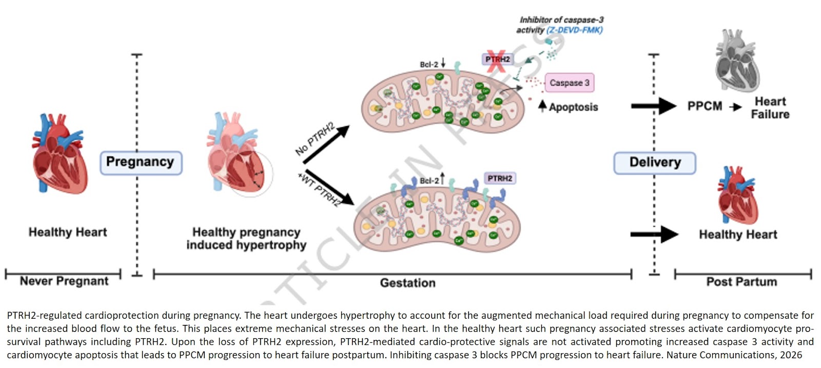 Peptidyl-tRNA hydrolase 2 is a negative regulator of peripartum cardiomyopathy with heart failure in female mice