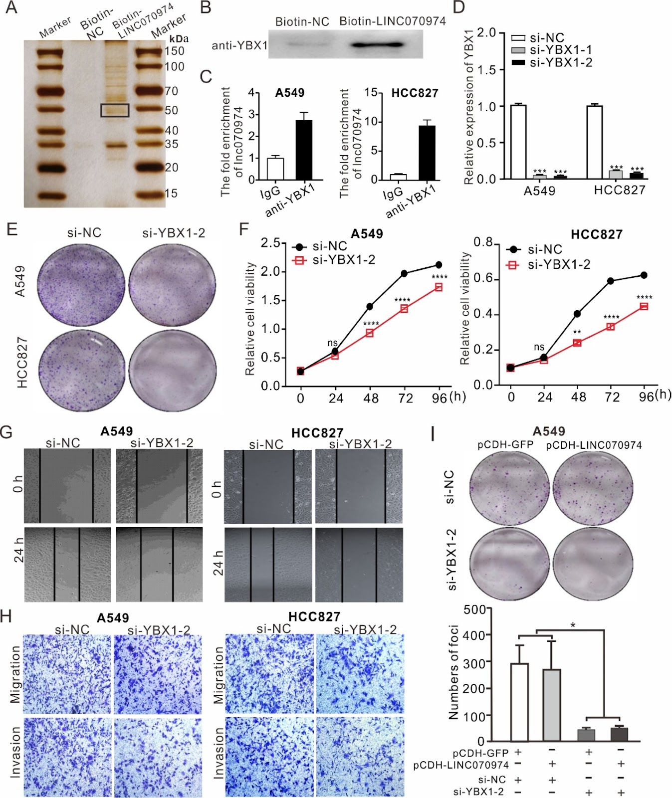 Targeting LINC070974 inhibits lung adenocarcinoma cell proliferation and progression by interacting with Y-box binding protein 1