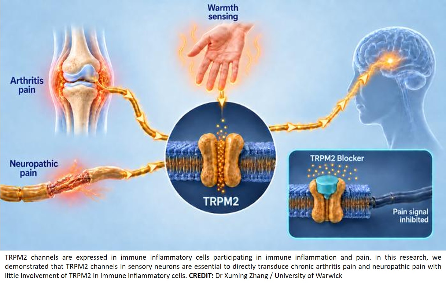 TRPM2 is a direct transducer for chronic pain 