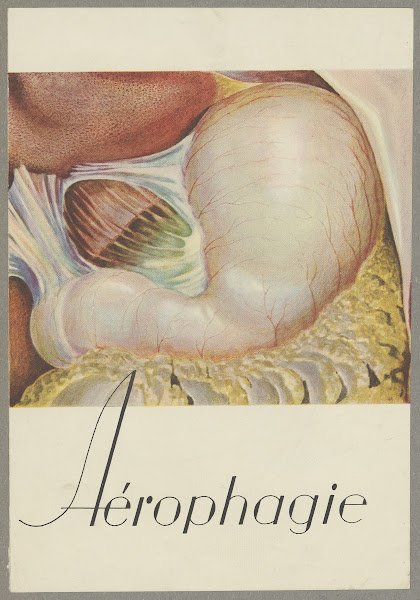 Aérophagie 1910 1950