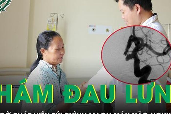 Đi khám đau lưng, người phụ nữ bất ngờ phát hiện túi phình mạch máu não nguy hiểm - Báo Sức Khỏe &amp; Đời Sống