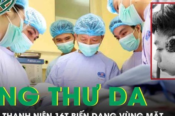 Nam thanh niên 16 tuổi ung thư da vỡ loét, gây biến dạng vùng mặt - Báo Sức Khỏe &amp; Đời Sống