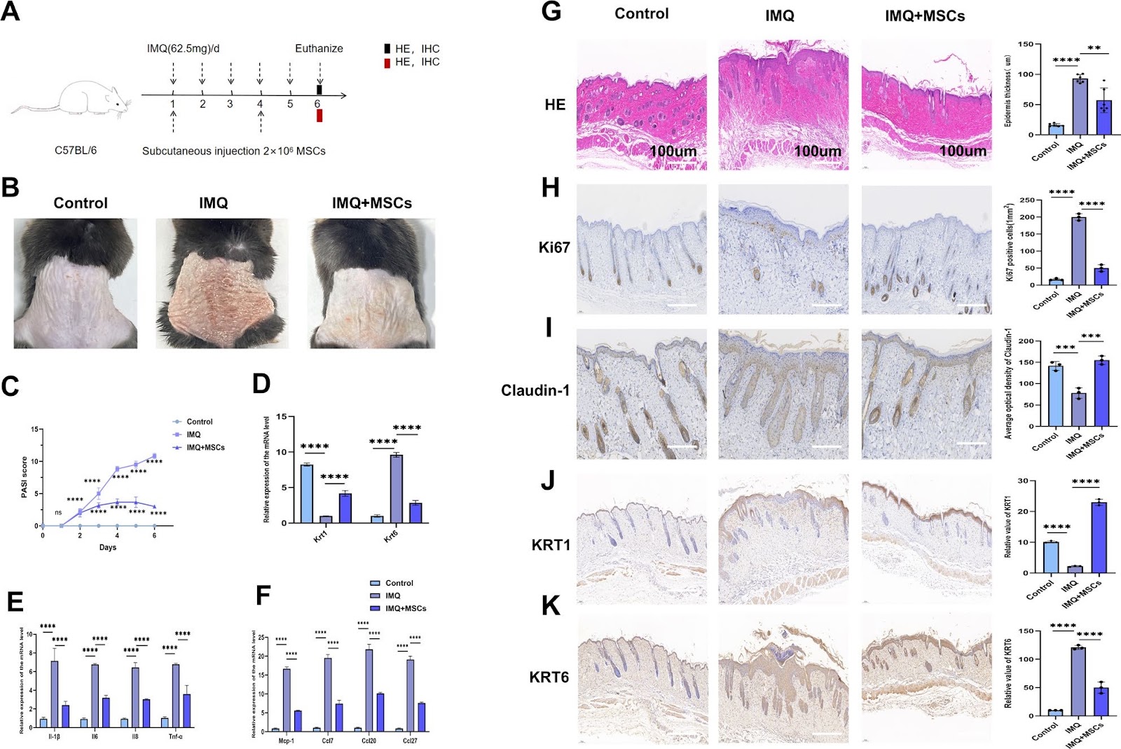 Research based on serine metabolism indicates mesenchymal stem cells alleviate psoriasis by regulating the PSPH-PINK1-Parkin-NLRP3 pathway in HaCaT
