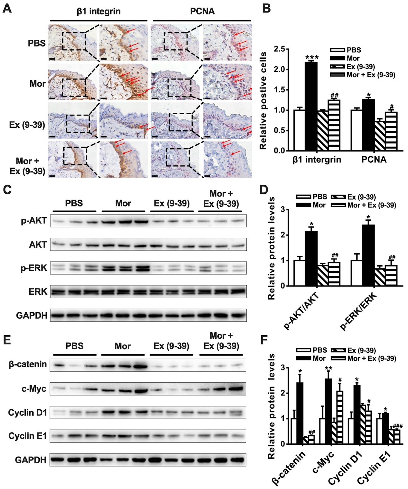 Morroniside promotes skin wound re-epithelialization by facilitating epidermal stem cell proliferation through GLP-1R-mediated upregulation of β-catenin expression
