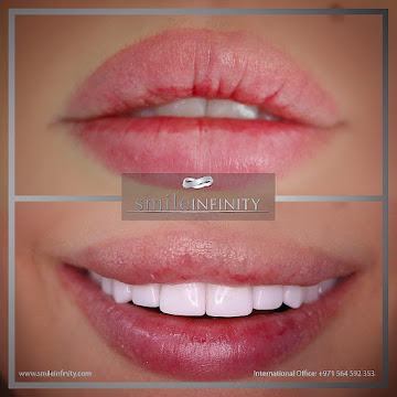 Hollywood smile medical tourism Britain Beirut Lebanon Ferrari Dental Clinic Dr Habib Zarifeh Smile Infinity 2026