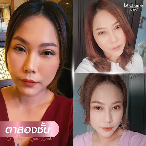ตา 2 ชั้น