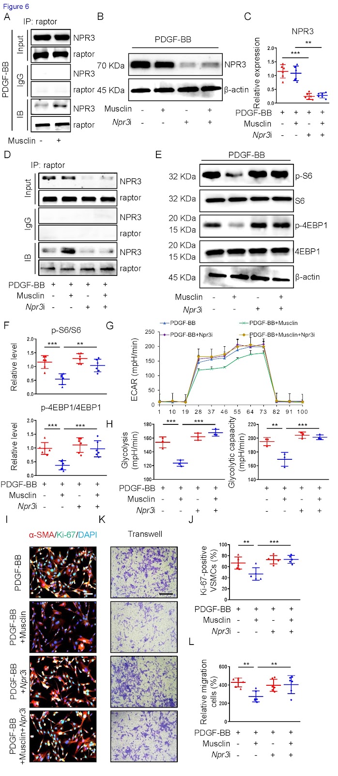 Inhibition of vascular intimal hyperplasia by the myokine Musclin: the role of NPR3/raptor/mTORC1-mediated glycolysis and phenotypic switching of VSMCs