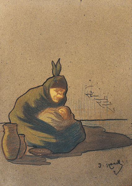 Female Cretin In Boí From 1896 Until 1897