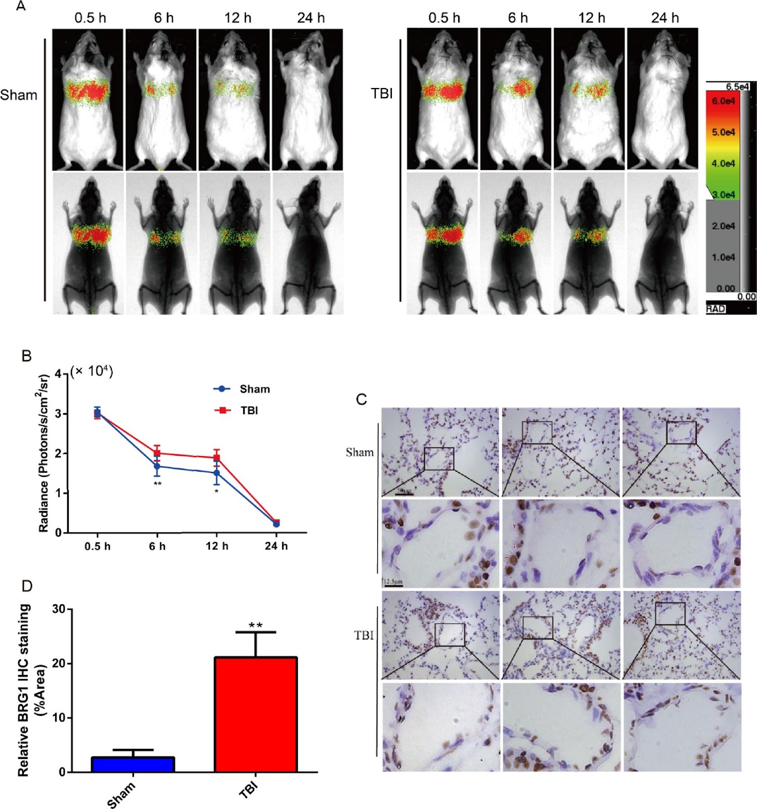 E2 pretreatment alleviates aggregation of intravenously injected mesenchymal stem cells in TBI by regulating BRG1 to affect adhesion
