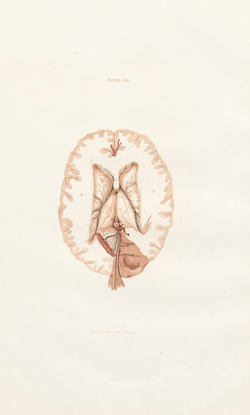 Anatomy of the brain Pl08 1854