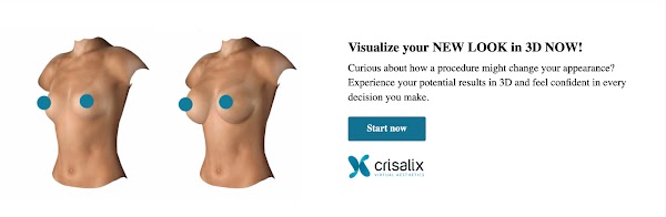 Bannière web Crisalix en ligne - Poitrine