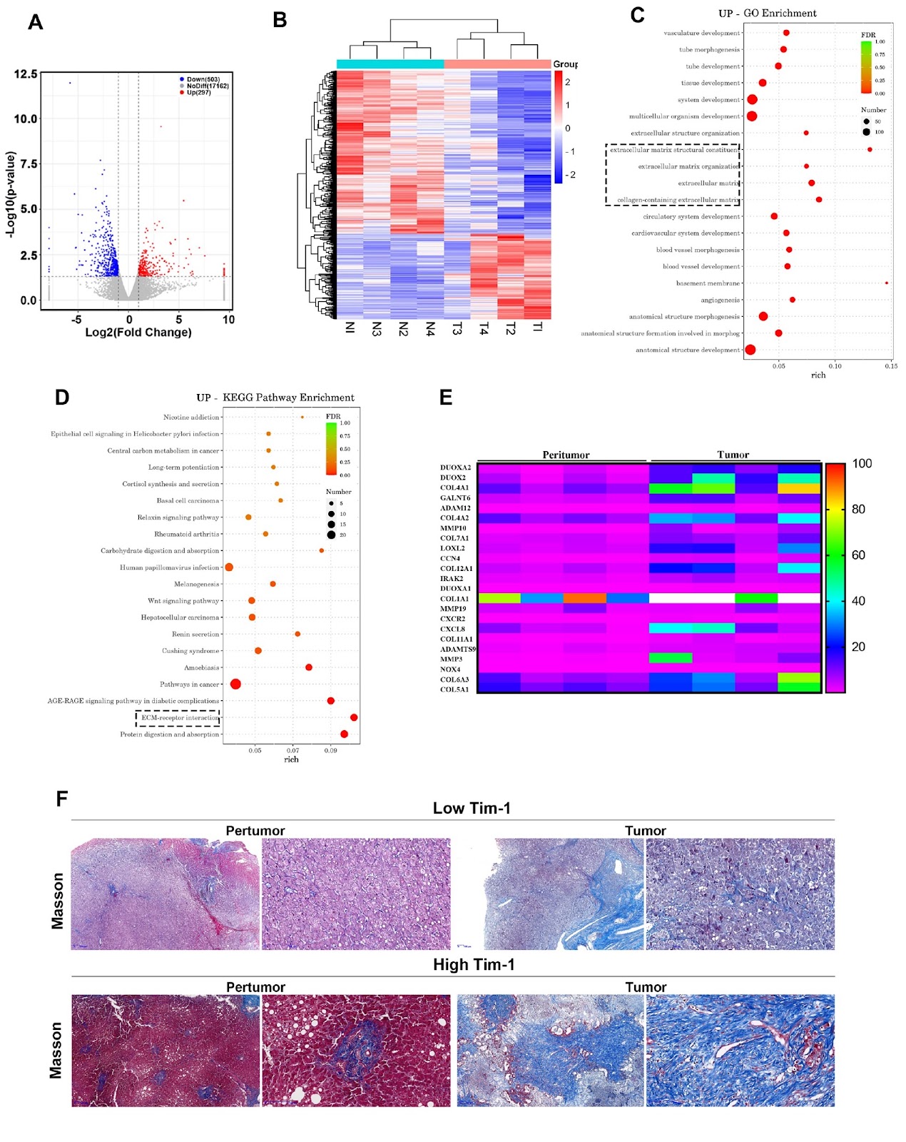Tim-1-mediated extracellular matrix promotes the development of hepatocellular carcinoma