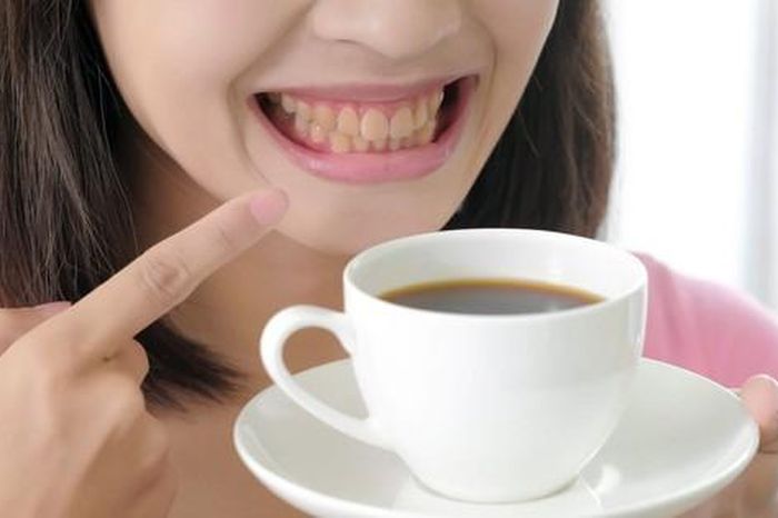 5 cách uống cà phê không lo răng bị ố vàng - Báo Sức Khỏe &amp; Đời Sống
