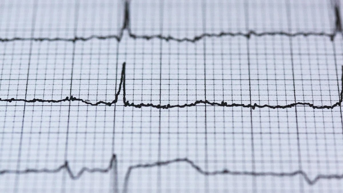 혈압 정상범위 단계별 건강 관리 전략