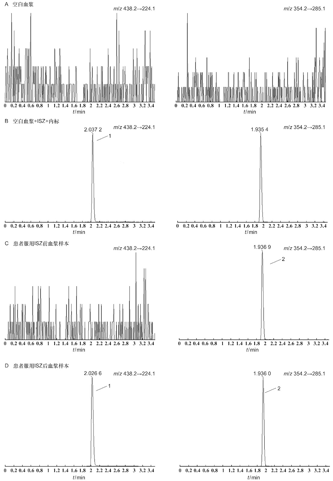 Establishment and Validation of a Prognostic Nomogram for Predicting Overall Survival in Patients with Non-Small Cell Lung Cancer Based on the Inflammatory Burden Index