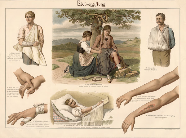 Blood poisoning 1911