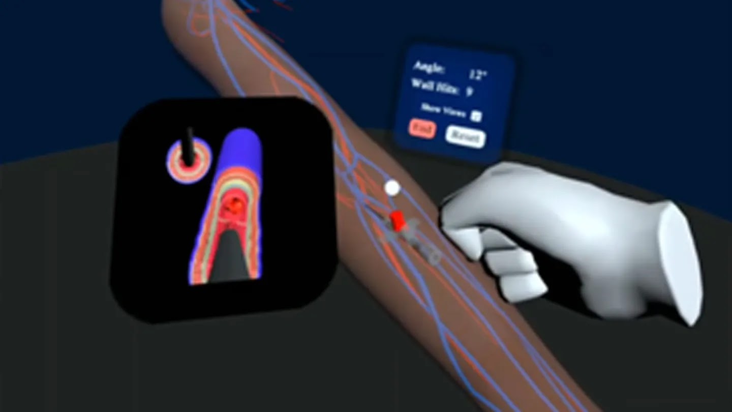 XR Cannulation screenshot