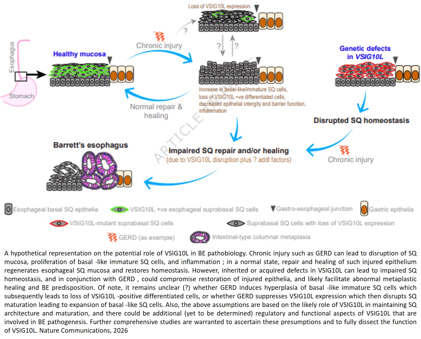 VSIG10L is a major determinant of esophageal homeostasis and inherited predisposition to Barrett’s esophagus
