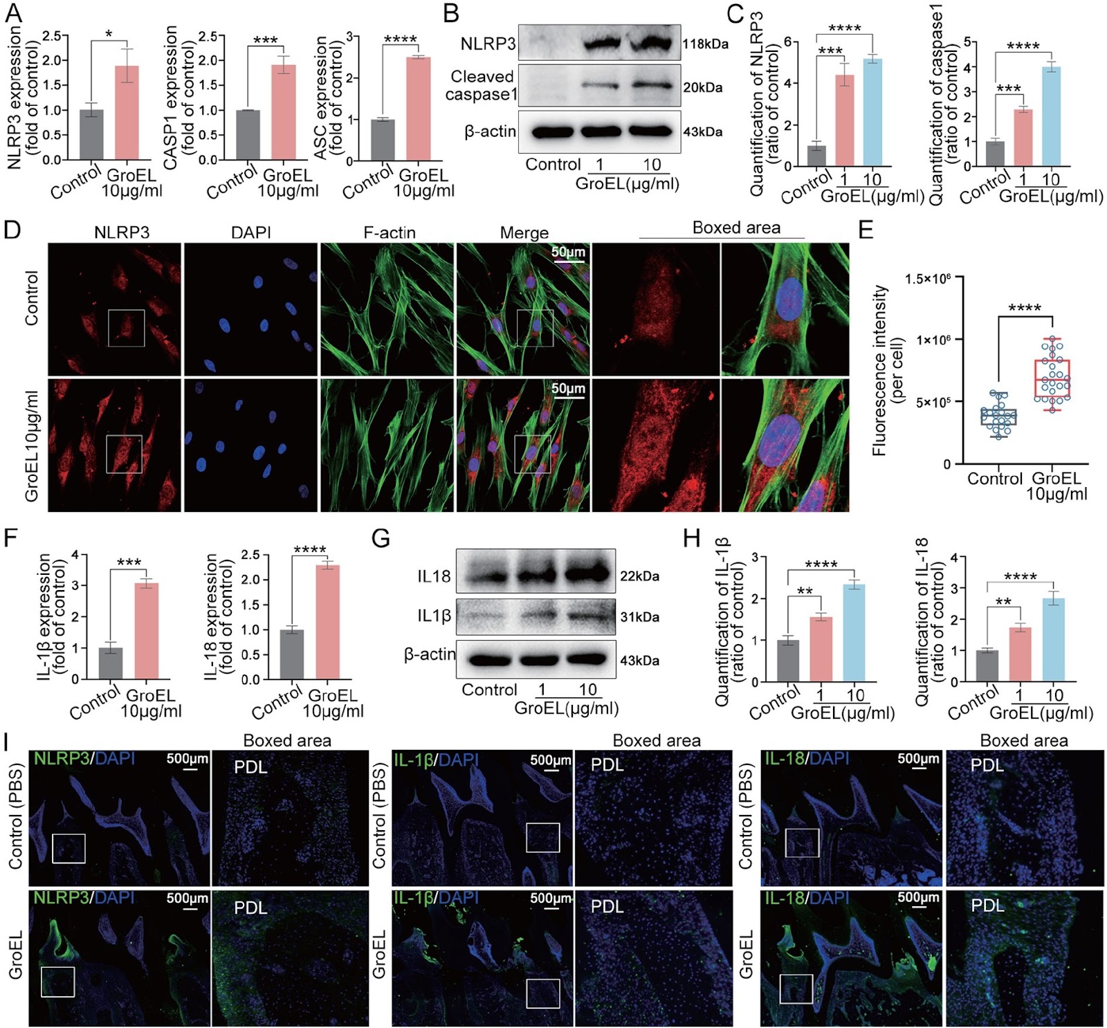 GroEL triggers NLRP3 inflammasome activation through the TLR/NF-κB p-p65 axis in human periodontal ligament stem cells