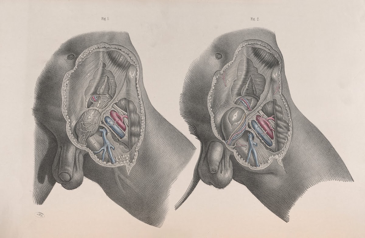 Surgical anatomy Pl29 1856