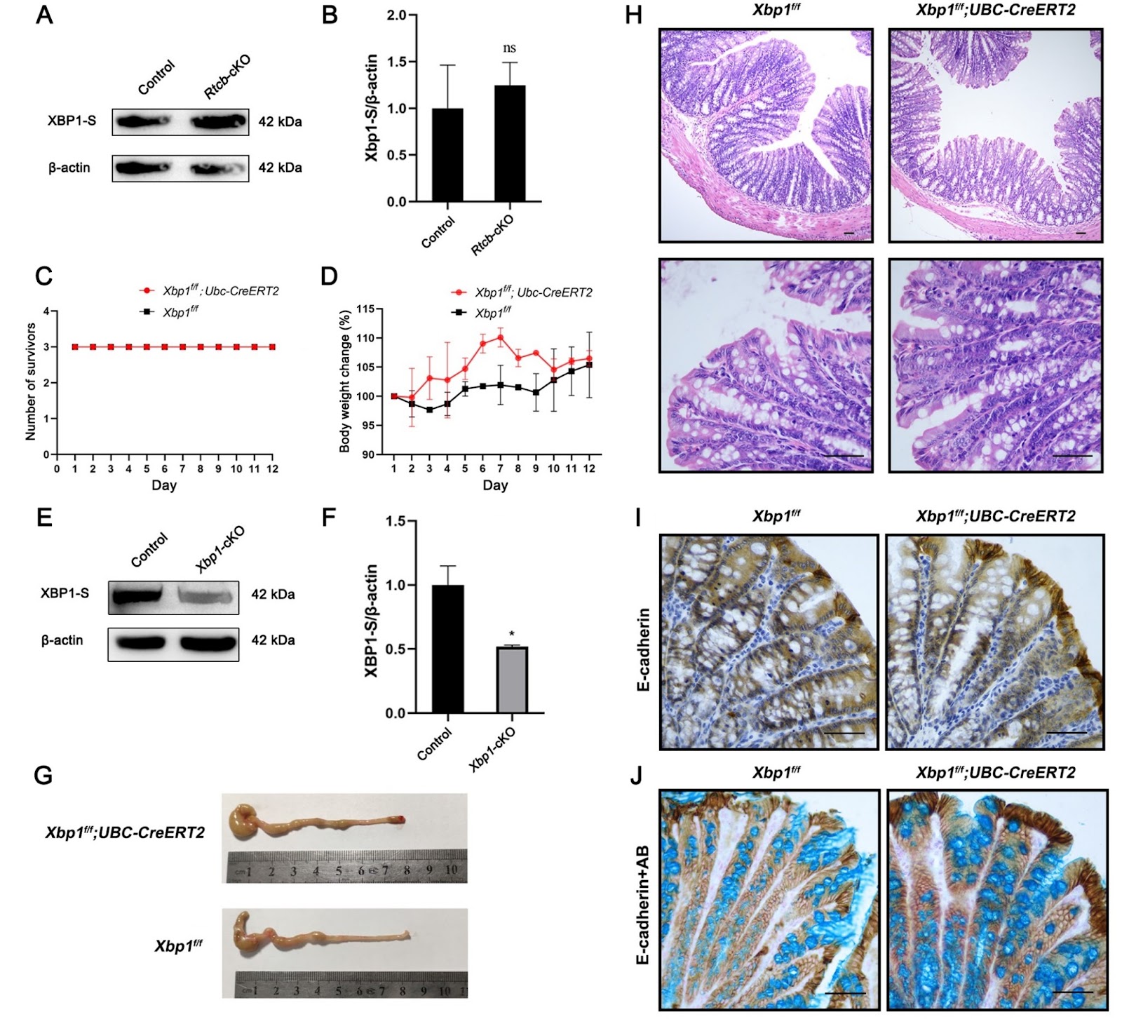 RTCB deficiency triggers colitis in mice by influencing the NF-κB and Wnt/β-catenin signaling pathways