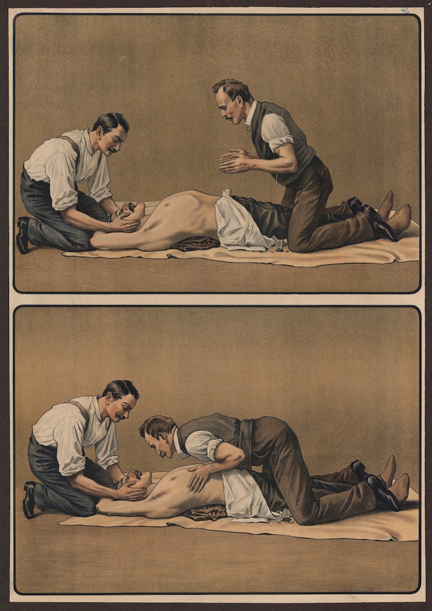Artificial respiration 1911
