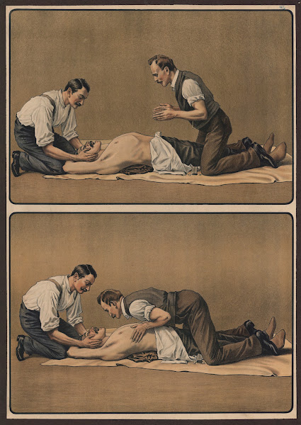 Artificial respiration 1911