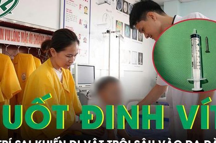 Bé 21 tháng tuổi nuốt đinh vít, người nhà xử trí sai cách khiến dị vật trôi sâu vào dạ dày - Báo Sức Khỏe &amp; Đời Sống
