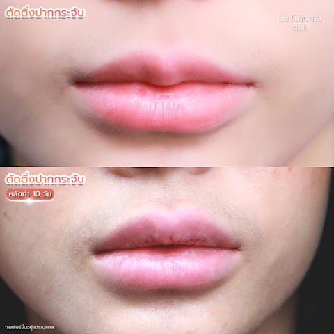 ตกแต่งริมฝีปาก