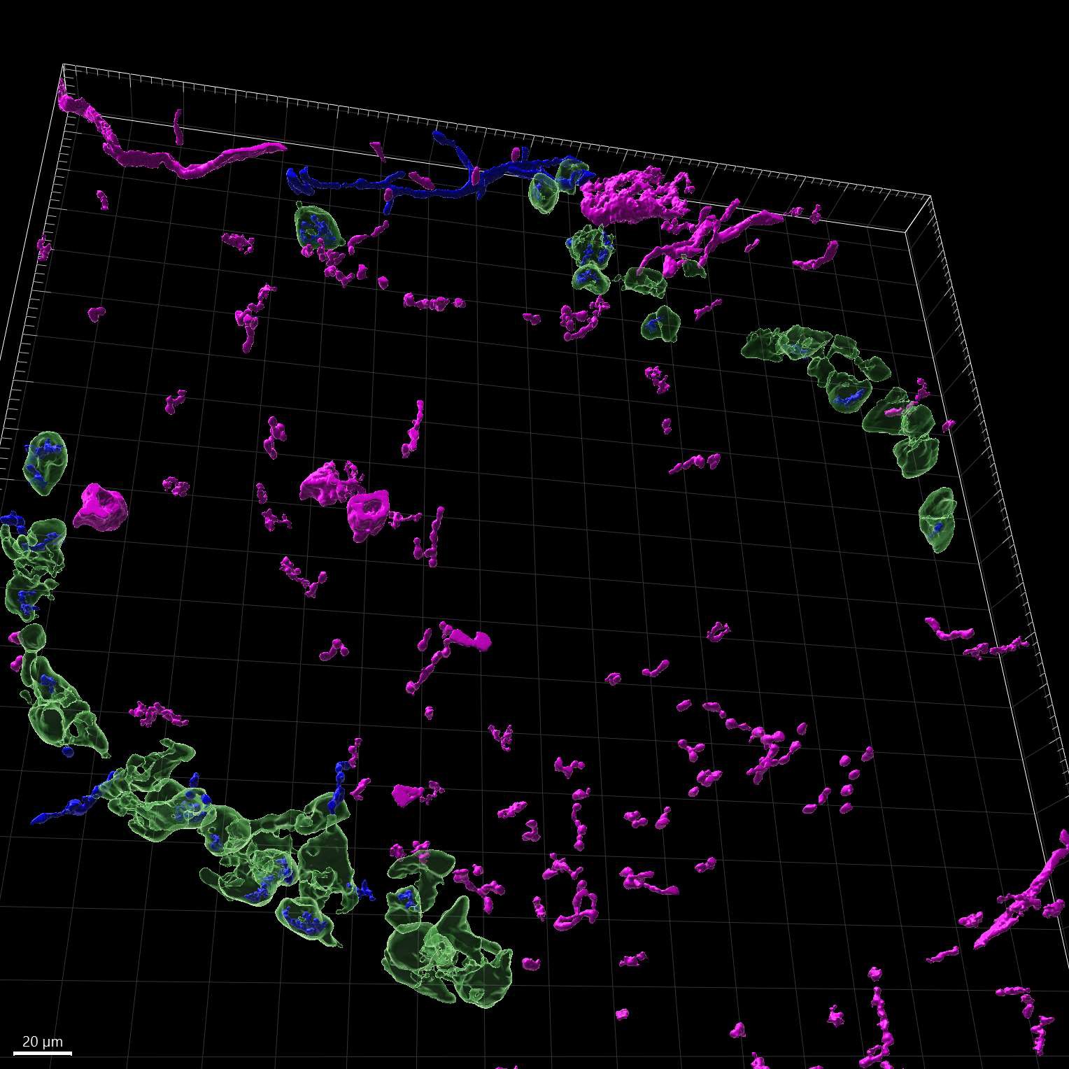 High-resolution imaging atlas reveals the context-dependent role of pancreatic sympathetic innervation in diabetic mice