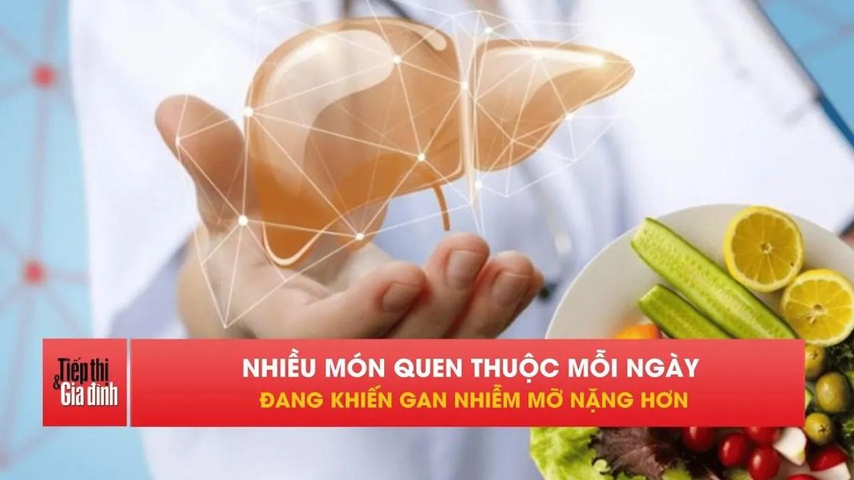 Người bị gan nhiễm mỡ nên tránh xa những món ăn này - Tạp chí Tiếp thị &amp; Gia đình