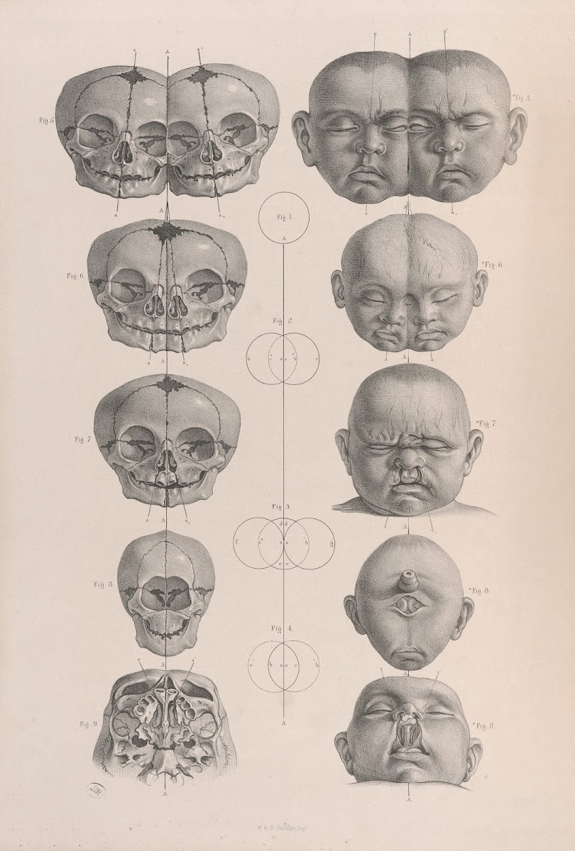 Surgical anatomy Pl19 1856