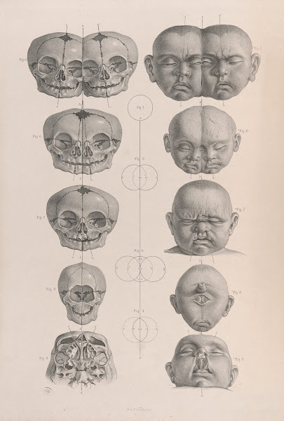 Surgical anatomy Pl19 1856