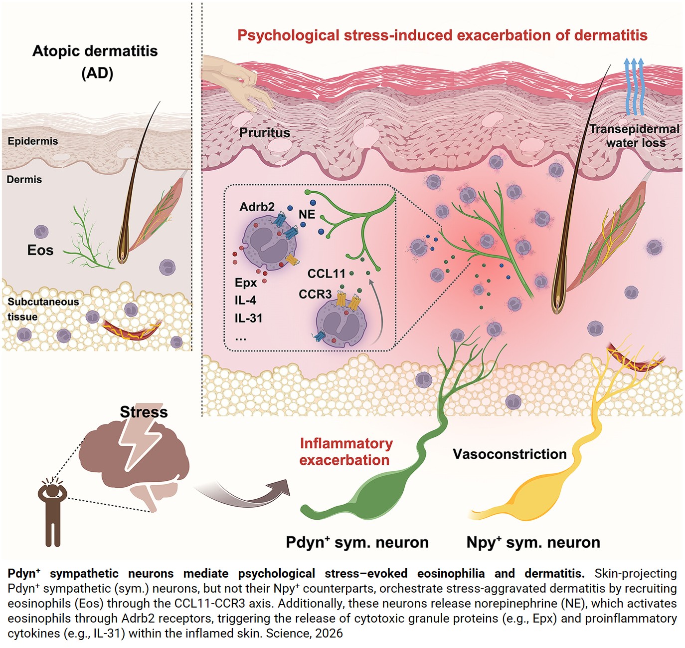 Psychological stress to exacerbate skin inflammation via brain-immune axis